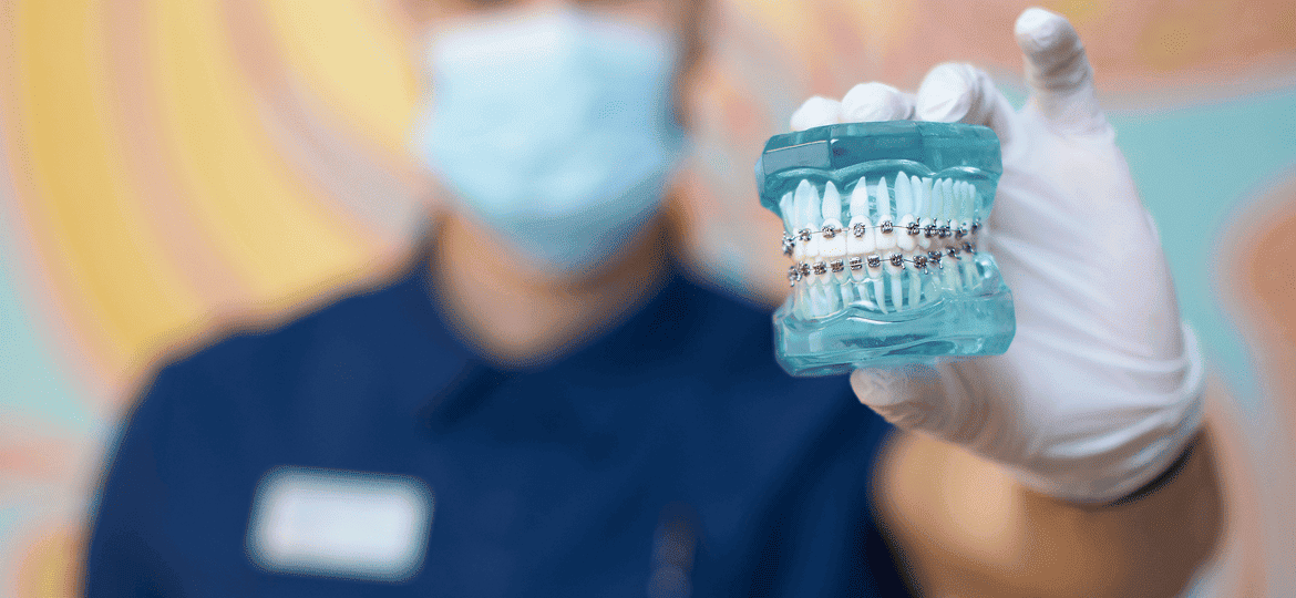 Виды ортодонтических аппаратов: полный гид по современным решениям